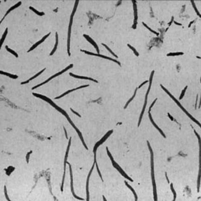 Ni Resist (Austenitic) Cast Iron Micro structure